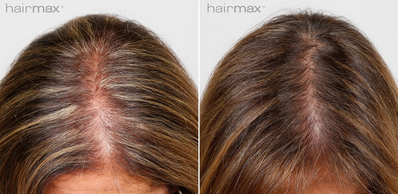 Before and after results