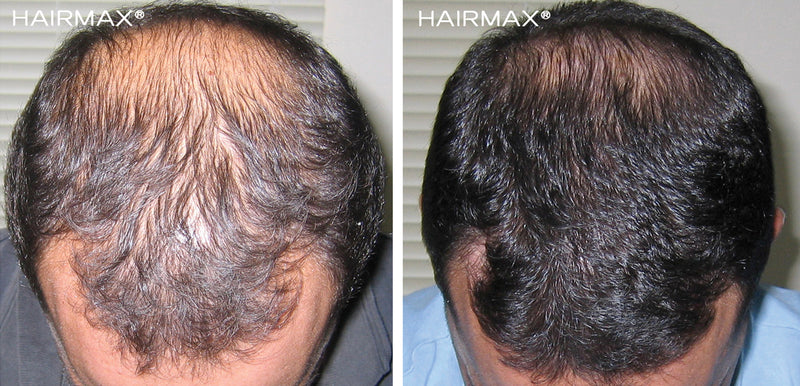 Before and after results