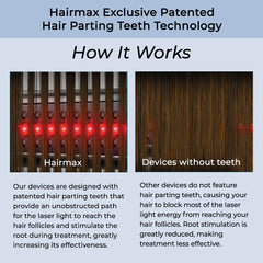 HairMax® LaserBand 82 *New Comfortflex Design*