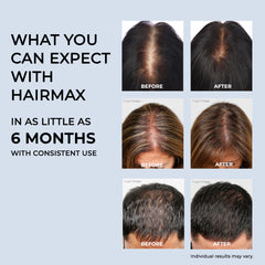 HairMax® PowerFlex Laser Cap 272